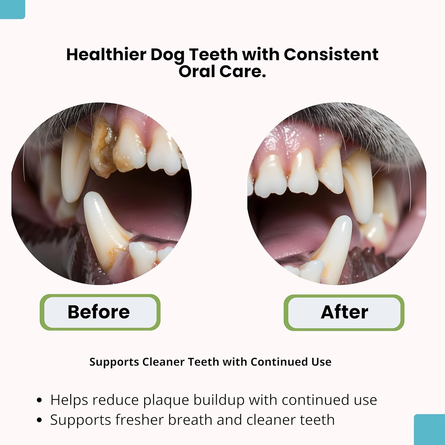 Before after teeth